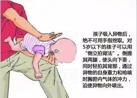 儿童吃了硬币怎么办图3