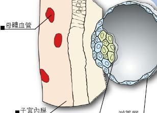 胎盘到底能不能吃,胎盘局部增厚会恢复正常吗图3