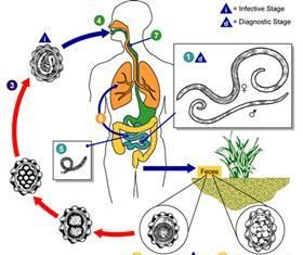 如何判断身体里有蛔虫,怎么判断肚子里有蛔虫图1