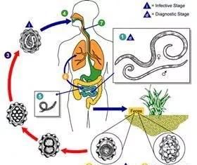 如何判断身体里有蛔虫,怎么判断肚子里有蛔虫图3