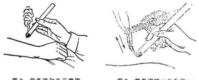 怎样学艾灸(怎样学艾灸零基础入门到精通)图2