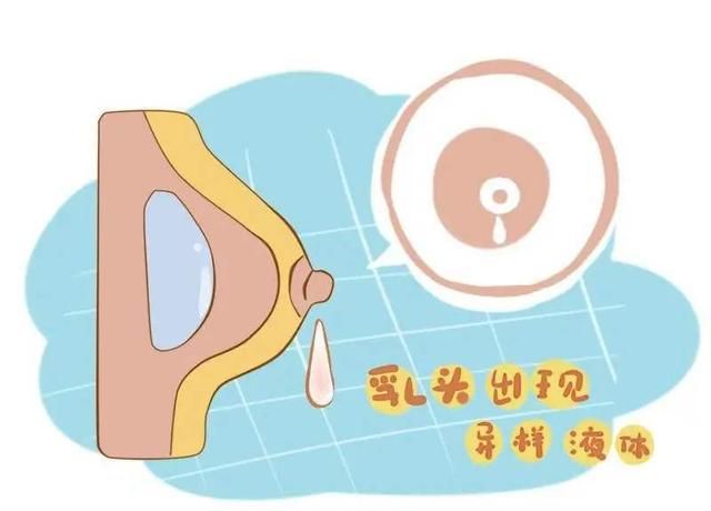 乳腺癌早期有什么症状图2