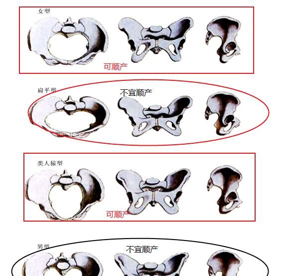 为什么老人说找媳妇要找脸大图1