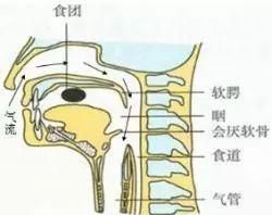 吞下口香糖会有什么后果,吞下口香糖之后该做什么图6