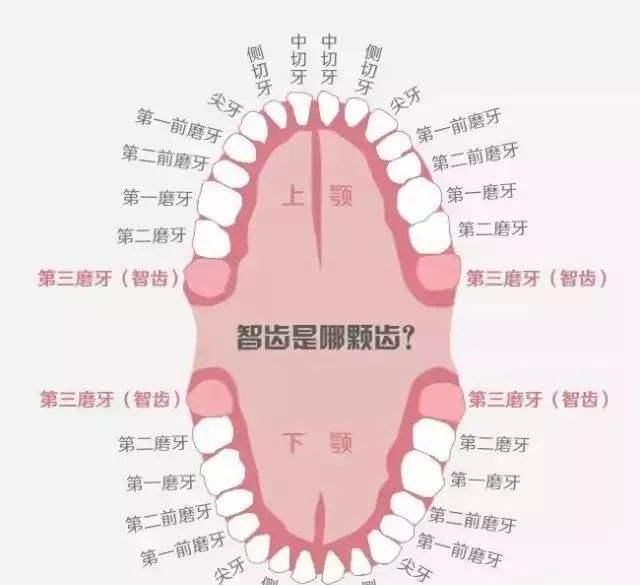 什么是智齿智齿需要拔除吗(下颌智齿比上颌智齿难拔吗)图10