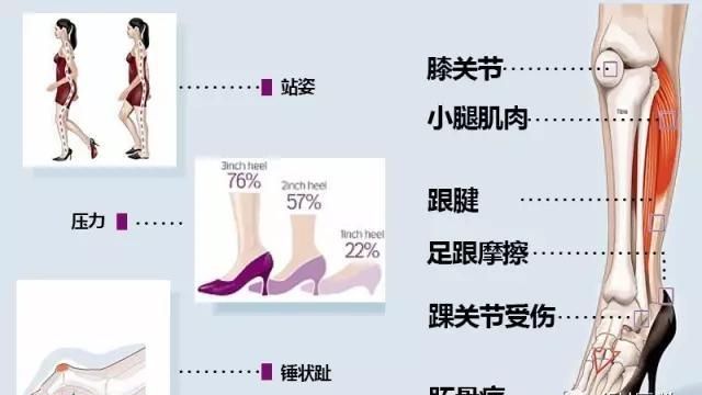 女人穿高跟鞋的危害有哪些(女人经常穿高跟鞋有什么害处)图8