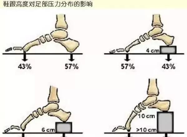 女人穿高跟鞋的危害有哪些(女人经常穿高跟鞋有什么害处)图9