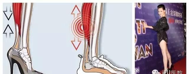 女人穿高跟鞋的危害有哪些(女人经常穿高跟鞋有什么害处)图15