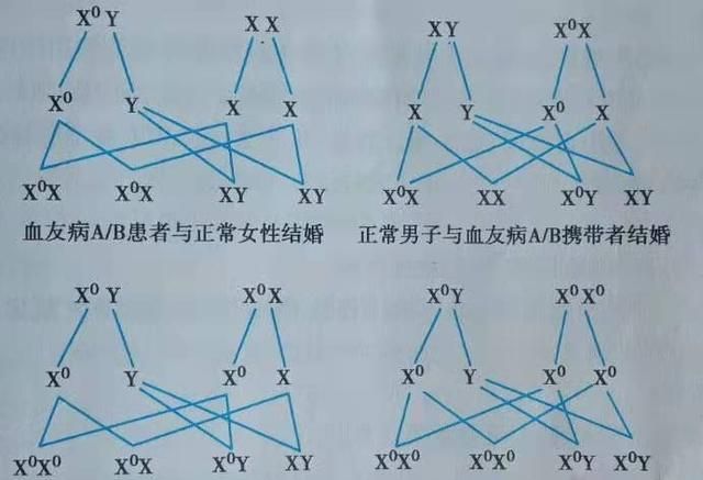 血友病母亲会遗传所有孩子吗图1