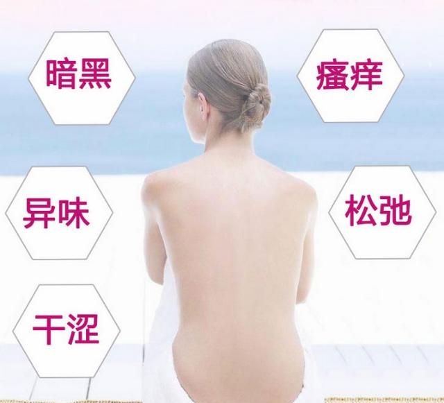 女性有多毛症怎么治图4