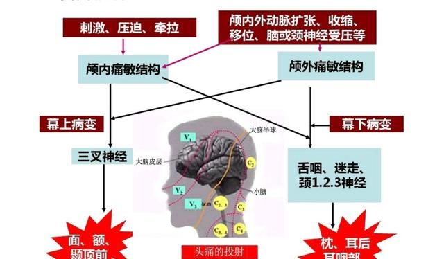 头痛怎么办最快最有效图2