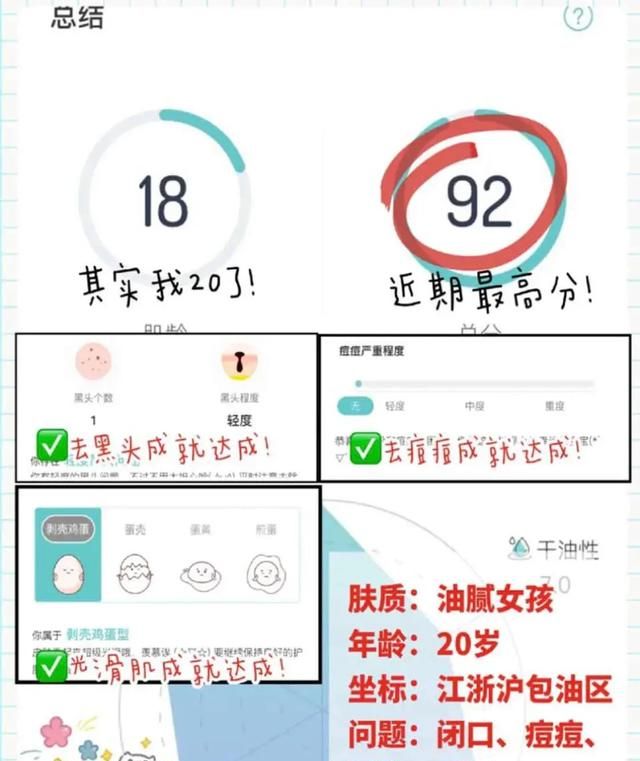 怎样去粉刺,怎样去粉刺闭口图2